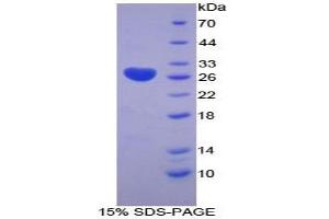 SDS-PAGE analysis of Human LOXL3 Protein. (LOXL3 Protéine)