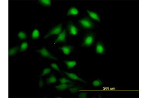 Immunofluorescence of monoclonal antibody to NME1 on HeLa cell. (NME1 anticorps  (AA 1-152))