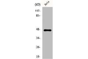 Western Blot analysis of HeLa cells using Cytokeratin 20 Polyclonal Antibody (Keratin 2 anticorps  (C-Term))