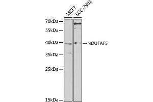 Western blot analysis of extracts of various cell lines, using NDUF antibody (ABIN6128985, ABIN6144470, ABIN6144471 and ABIN6222949) at 1:1000 dilution. (C20orf7 anticorps  (AA 196-345))