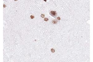 ABIN6267530 at 1/100 staining human brain tissue sections by IHC-P.