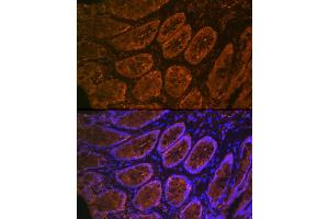 Immunofluorescence analysis of rat rectum cells using CE Rabbit mAb (ABIN7266085) at dilution of 1:100 (40x lens). (CEACAM6 anticorps)