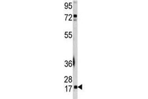 Western blot analysis of UBE2I antibody and A2058 lysate.