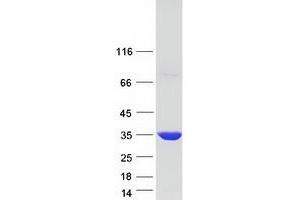 Validation with Western Blot
