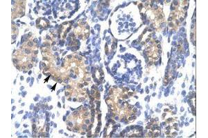 Image no. 1 for anti-Proteasome (Prosome, Macropain) 26S Subunit, ATPase, 3 (PSMC3) (AA 293-339) antibody (ABIN202439)