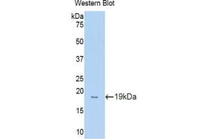 Western blot analysis of the recombinant protein. (Glucocorticoid Receptor anticorps  (AA 622-755))