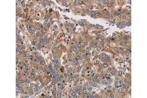 Immunohistochemistry (IHC) image for anti-Potassium Voltage-Gated Channel, Subfamily G, Member 1 (KCNG1) antibody (ABIN5549987)