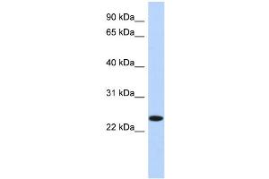 WB Suggested Anti-NKAIN4 Antibody Titration: 0. (NKAIN4 anticorps  (N-Term))