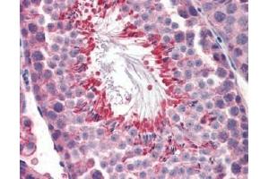 IHC Image for AP22588PU-N Mouse Testis (formalin-fixed, paraffin-embedded) stained with M6PRBP1followed by biotinylated anti-goat IgG secondary antibody LS-D3, alkaline phosphatase-streptavidin and chromogen. (PLIN3 anticorps  (Internal Region))