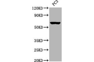 Western Blot Positive WB detected in:PC3 whole cell lysate All lanes: Muscarinic Acetylcholine Receptor M3 antibody at 1:2000 Secondary Goat polyclonal to rabbit IgG at 1/50000 dilution Predicted band size: 67 kDa Observed band size: 67 kDa (Recombinant CHRM3 anticorps)