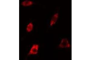 ABIN6278624 staining 293 cells by IF/ICC. (RAB35 anticorps  (Internal Region))