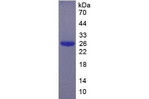 SDS-PAGE of Protein Standard from the Kit (Highly purified E. (EBI3 Kit CLIA)