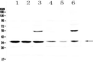 Western blot analysis of JunD using anti-JunD antibody . (JunD anticorps)