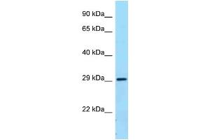 WB Suggested Anti-FCGR2B Antibody Titration: 1. (FCGR2B anticorps  (C-Term))