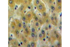 Used in DAB staining on fromalin fixed paraffin-embedded Liver tissue