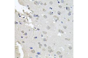 Immunohistochemistry of paraffin-embedded mouse brain using PKN1 antibody. (PKN1 anticorps)