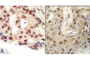 Image no. 2 for anti-Protein Kinase, CGMP-Dependent, Type II (PRKG2) (C-Term) antibody (ABIN360423)