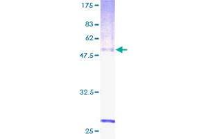 Image no. 1 for Retinal G Protein Coupled Receptor (RGR) (AA 1-295) protein (GST tag) (ABIN1317918)