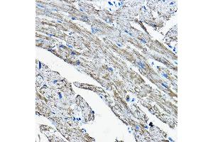 Immunohistochemistry of paraffin-embedded mouse heart using OGDHL Rabbit pAb (ABIN7269135) at dilution of 1:200 (40x lens). (OGDHL anticorps  (AA 1-110))