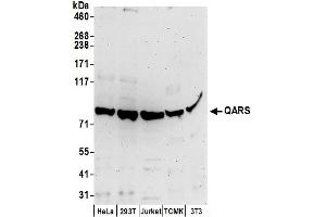 anti-Glutaminyl-tRNA Synthetase (QARS) (AA 725-775) antibody