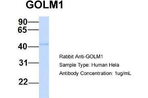 Host: Rabbit Target Name: GOLM1 Sample Type: Human Hela Antibody Dilution: 1. (GOLM1 anticorps  (N-Term))