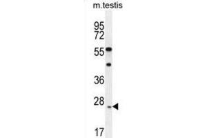 Western Blotting (WB) image for anti-Rhophilin Associated Tail Protein 1-Like (ROPN1L) antibody (ABIN2996402)