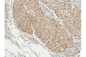 Immunohistochemistry analysis using Rabbit Anti-Alpha Synuclein pSer129 Polyclonal Antibody (ABIN5650947). (SNCA anticorps  (pSer129) (Biotin))