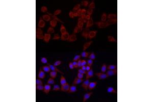 Immunofluorescence analysis of HeLa cells using SRP72 Rabbit pAb (ABIN6134166, ABIN6148452, ABIN7101299 and ABIN7101300) at dilution of 1:100 (40x lens). (SRP72 anticorps)