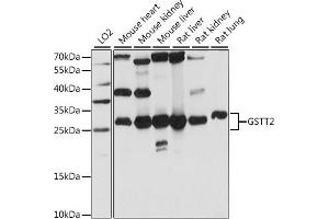 Western blot analysis of extracts of various cell lines, using GSTT2 antibody (ABIN7267449) at 1:1000 dilution. (GSTT2 anticorps  (AA 1-244))