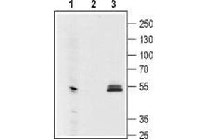 Western blot analysis using Mouse Anti-GIRK1 (Kir3. (KCNJ3 anticorps  (Extracellular Loop))