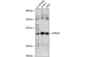 Western blot analysis of extracts of various cell lines, using NTPCR antibody (ABIN7269059) at 1:1000 dilution. (C1orf57 anticorps  (AA 91-190))