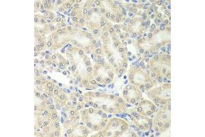 Immunohistochemistry of paraffin-embedded mouse kidney using PRDX5 antibody. (Peroxiredoxin 5 anticorps  (AA 53-214))
