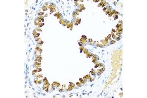 Immunohistochemistry of paraffin-embedded mouse lung using NRG4 antibody (ABIN3016309, ABIN3016310, ABIN3016311 and ABIN6219713) at dilution of 1:100 (40x lens).