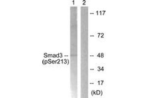 Western blot analysis of extracts from HT29 cells, using Smad3 (Phospho-Ser213) Antibody. (SMAD3 anticorps  (pSer213))