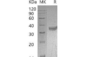 Western Blotting (WB) image for Carbonic Anhydrase IV (CA4) (AA 18-277) protein (His tag) (ABIN7320479)