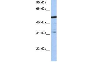 WB Suggested Anti-ZFAntibody Titration:  0. (ZFP14 anticorps  (N-Term))