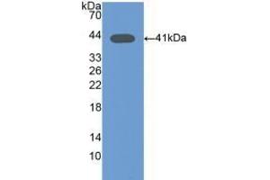 Detection of Recombinant Osteocalcin, Mouse using Polyclonal Antibody to Osteocalcin (OC) (Osteocalcin anticorps  (AA 14-95))