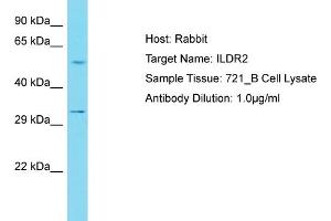 Host: Rabbit Target Name: ILDR2 Sample Tissue: Human 721_B Whole Cell Antibody Dilution: 1ug/ml (ILDR2 anticorps  (C-Term))