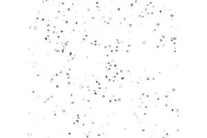 Immunocytochemistry (ICC) image for anti-Topo IIalpha (AA 650-700) antibody (ABIN7795795) (Recombinant Topo IIalpha (AA 650-700) anticorps)