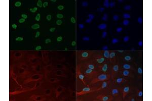 Immunofluorescence of Histone H3 K27me3 Antibody. (Histone 3 anticorps  (H3K27me3))