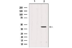 Western blot analysis of extracts from Mouse cancer, using AGPAT3 Antibody.