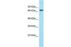 Host: Rabbit Target Name: ADCK2 Sample Type: Jurkat Whole Cell lysates Antibody Dilution: 1. (ADCK2 anticorps  (Middle Region))