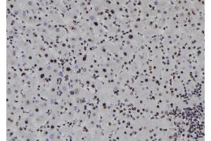 ABIN6278217 at 1/100 staining Human liver tissue by IHC-P. (SOX1 anticorps  (Internal Region))