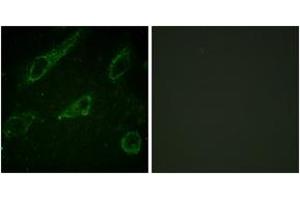 Immunofluorescence analysis of HeLa cells, using c-Abl (Phospho-Tyr245) Antibody. (ABL1 anticorps  (pTyr245))