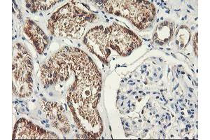 Immunohistochemical staining of paraffin-embedded Human Kidney tissue using anti-PDSS2 mouse monoclonal antibody. (PDSS2 anticorps)
