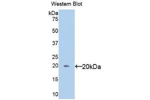 Detection of Recombinant gp130, Human using Polyclonal Antibody to Glycoprotein 130 (gp130) (CD130/gp130 anticorps  (AA 392-566))