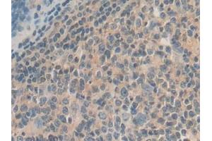 Detection of GDF10 in Human Stomach Tissue using Polyclonal Antibody to Growth Differentiation Factor 10 (GDF10)