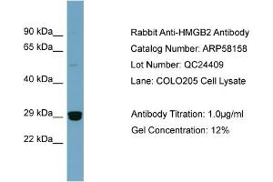 WB Suggested Anti-HMGB2  Antibody Titration: 0. (HMGB2 anticorps  (Middle Region))