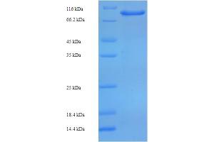 SDS-PAGE (SDS) image for Coiled-Coil Domain Containing 36 (CCDC36) (AA 11-592), (partial) protein (His-SUMO Tag) (ABIN5711515)