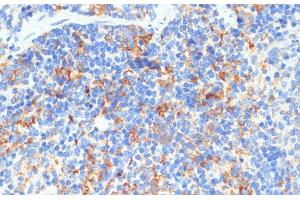 Immunohistochemistry of paraffin-embedded Mouse spleen using DDX3X Polyclonal Antibody at dilution of 1:100 (40x lens).
